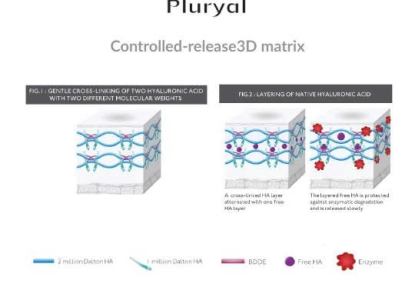 Giải mã công nghệ Matricyal® 3D: Nền tảng khoa học của một Biofiller thế hệ mới