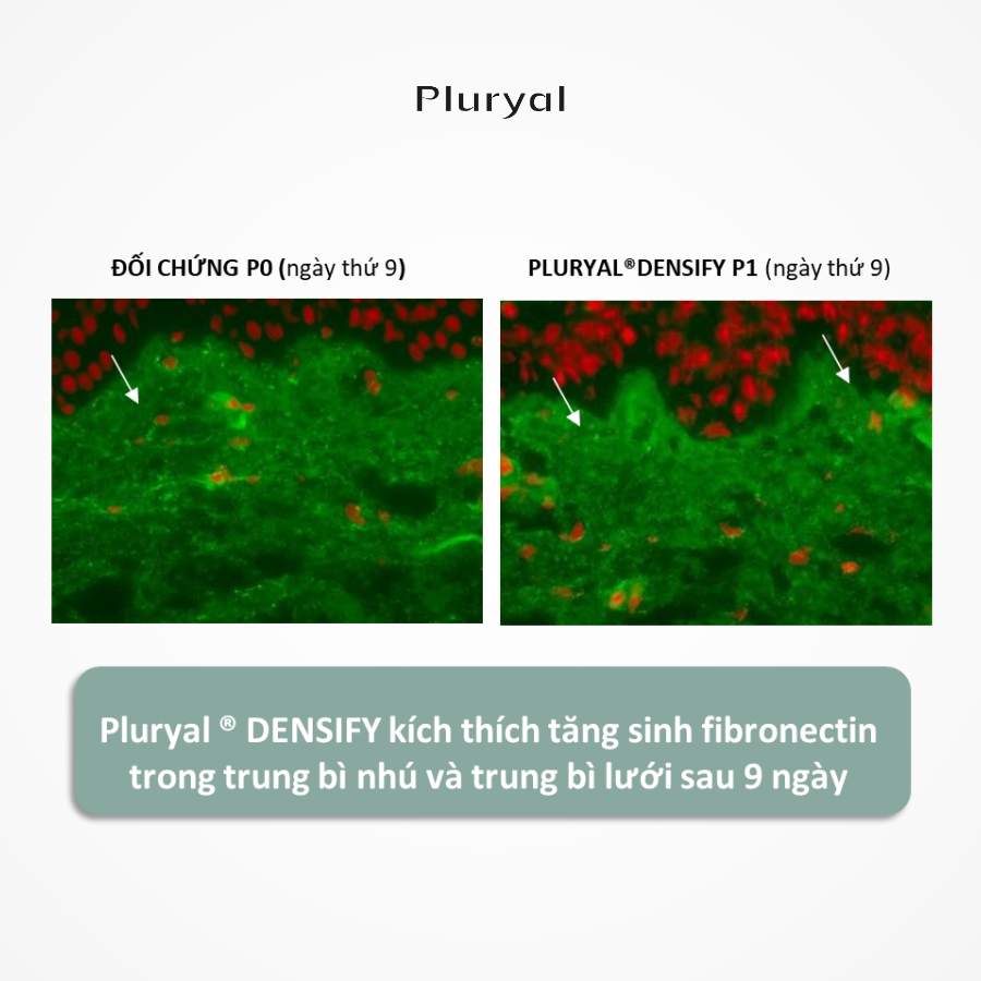 Pluryal Densify kích thích tăng sinh Fibronectin trong trung bì nhú và trung bì lưới sau 9 ngày